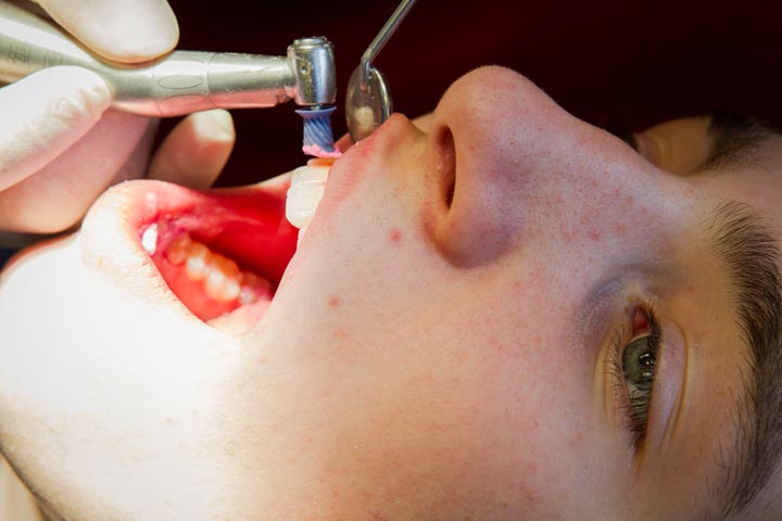 Prävention / Prophylaxe sind die Grundlage für gesunde Zähne.